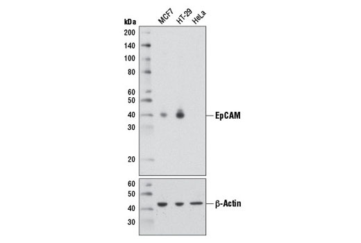Western blot analysis of extracts from MCF7 (EpCAM positive), HT-29 (EpCAM positive), and HeLa (EpCAM negative) cells using EpCAM (D1B3) Rabbit mAb (upper) or β-Actin (D6A8) Rabbit mAb #8457 (lower).