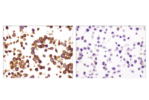 Immunohistochemical analysis of paraffin-embedded HT-29 (left) and HeLa (right) cells using EpCAM (D9S3P) Rabbit mAb (IHC Preferred).