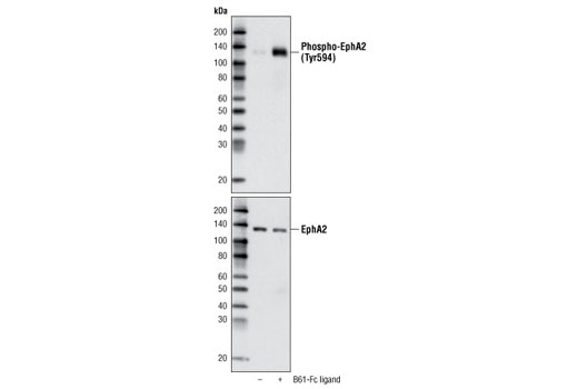 Western blot analysis of cell extracts from 293-T cells, transfected with human EphA2 expression construct, untreated or stimulated with B61-Fc ligand, using Phospho-EphA2 (Tyr594) Antibody (upper) or EphA2 Antibody #3974 (lower).