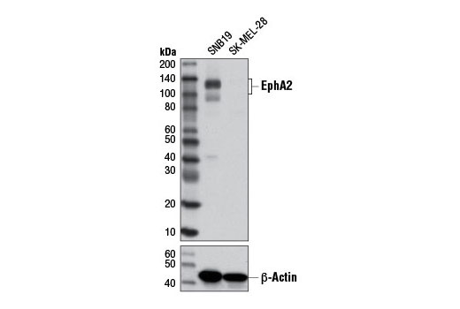 Western blot analysis of extracts from SNB19 and SK-MEL-28 cell lines using EphA2 (8B6) Mouse mAb (upper) and β-Actin (D6A8) Rabbit mAb #8457 (lower).