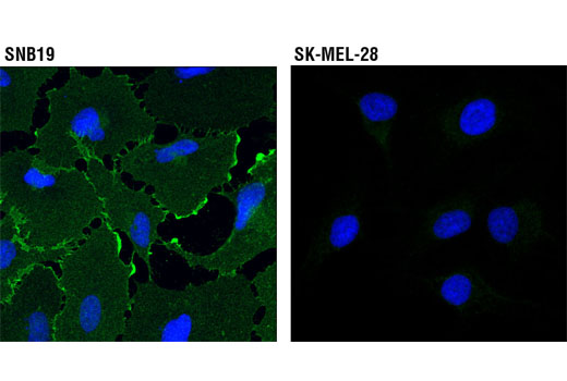 Confocal immunofluorescent analysis of SNB19 (left) and SK-MEL-28 (right) cells using EphA2 (8B6) Mouse mAb (green). Blue pseudocolor = DRAQ5 ® #4084 (fluorescent DNA dye).