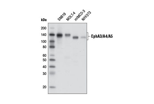 Western blot analysis of extracts from various cell lines using EphA3/A4/A5 (D2C11) Rabbit mAb.