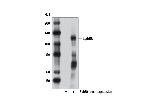 Western blot analysis of extracts from 293 cells, untransfected (-) or transfected with EphB6 overexpression vector (+), using EphB6 Antibody.
