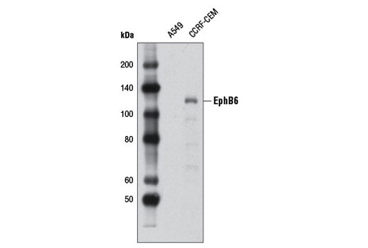 Western blot analysis of extracts from A549 (negative) and CCRF-CEM (positive) cells using EphB6 Antibody.