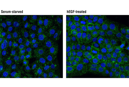 Confocal immunofluorescent analysis of A-431 cells, serum-starved (left) or treated with Human Epidermal Growth Factor (hEGF) #8916 (100 ng/mL, 1 hr, 4ºC; right), using Eps15 (D3K8R) Rabbit mAb (green). Blue pseudocolor = DRAQ5 ® #4084 (fluorescent DNA dye).