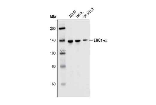 Western blot analysis of extracts from ACHN, HeLa and SK-MEL-5 cells using ERC1α (D1055) Antibody.