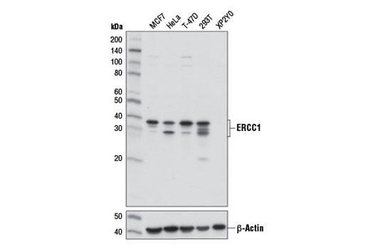 Western blot analysis of extracts from various cell lines using ERCC1 (D6G6) XP ® Rabbit mAb (upper) or β-Actin (D6A8) Rabbit mAb #8457 (lower).