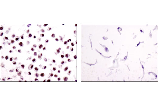 Immunohistochemical analysis of paraffin-embedded cell pellets, HeLa (left) or XP2Y0 (right), using ERCC1 (D6G6) XP ® Rabbit mAb.