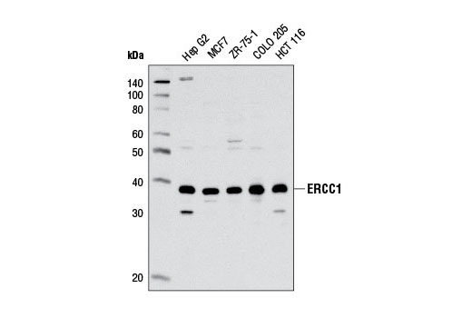 Western blot analysis of extracts from various cell lines using ERCC1 (D61F5) Rabbit mAb.