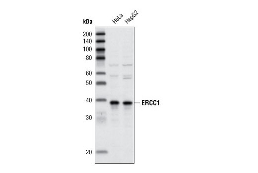 Western blot analysis of extracts from HeLa and HepG2 cells using ERCC1 Antibody.