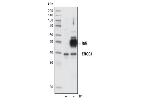 Immunoprecipitation of ERCC1 from HeLa cells using ERCC1 Antibody. Western blot was performed using the same antibody. Lane 1 is 5% input.
