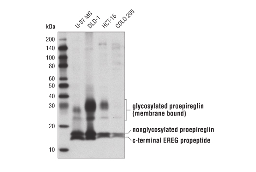 Western blot analysis of extracts from various cell lines using EREG (D4O5I) Rabbit mAb.
