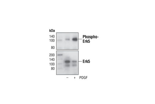 Immunoprecipitation of Erk5 from NIH/3T3 cells, untreated or PDGF-treated, using Erk5 Antibody #3372, followed by Western blot with Phospho-Erk5 (Thr218/Tyr220) Antibody #3371, or Erk5 Antibody #3372.