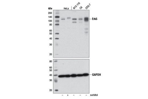 Western blot analysis of extracts from HeLa cells, untreated (-) or sorbitol-treated (400 mM, 15 min; +), and N1E-115, C6, and COS-7 cells using Erk5 (D3I5V) Rabbit mAb (upper) and GAPDH (D16H11) XP ® Rabbit mAb #5174 (lower).