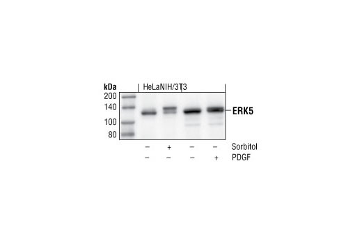 Western blot analysis of extracts from HeLa cells, untreated or sorbitol-treated and NIH/3T3 cells, untreated or PDGF-treated, using Erk5 Antibody.