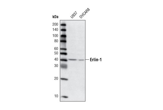 Western blot analysis of extracts from human U937 and ovcar8 cell lines using Erlin-1 Antibody.