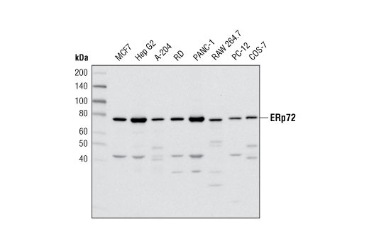 Western blot analysis of extracts from various cell lines using ERp72 (D70D12) XP ® Rabbit mAb.