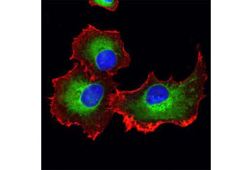 Confocal immunofluorescent analysis of PANC-1 cells using ERp72 (D70D12) XP ® Rabbit mAb (green) and β-Actin (8H10D10) Mouse mAb #3700 (red). Blue pseudocolor = DRAQ5 ® #4084 (fluorescent DNA dye).