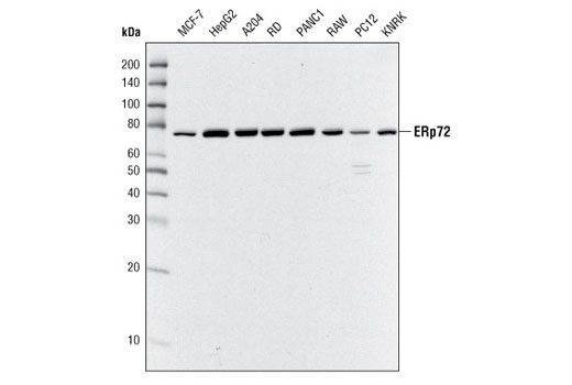Western blot analysis of extracts from various cell types using ERp72 Antibody.