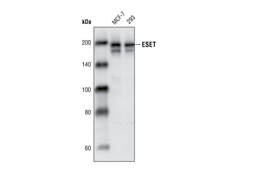 Western blot analysis of cell lysates from MCF7 and 293 cells using ESET (C1C12) Rabbit mAb.
