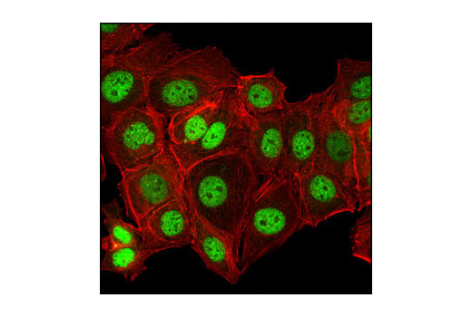 Confocal immunofluorescent analysis of MCF-7 cells using ESET (C1C12) Rabbit mAb (green). Actin filaments have been labeled with Alexa Fluor ® 555 phalloidin (red).