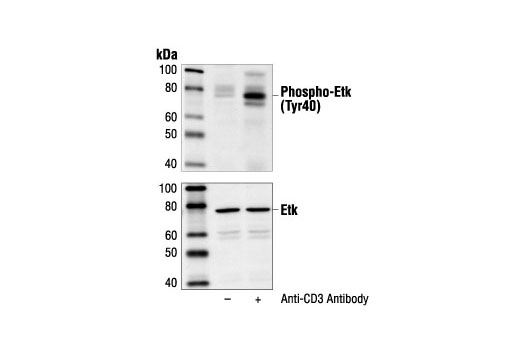 Western blot analysis of extracts from Jurkat cells, untreated (-) or anti-CD3 antibody-treated (+), using Phospho-Etk (Tyr40) Antibody (upper) or Etk Antibody #3212 (lower).