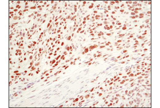 Immunohistochemical analysis of paraffin-embedded 4T1a mouse syngeneic tumor using Ezh2 (D2C9) XP ® Rabbit mAb.