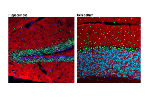 Confocal immunofluorescent analysis of mouse hippocampus (left) and cerebellum (right) using Ezh2 (D2C9) XP ® Rabbit mAb (green). Actin filaments were labeled with DyLight™ 554 Phalloidin #13054 (red). Blue pseudocolor = DRAQ5 ® #4084 (fluorescent DNA dye).