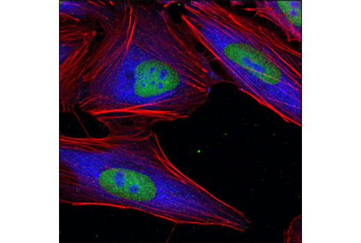 Confocal immunofluorescent analysis of HeLa cells using Ezh2 (D2C9) XP ® Rabbit mAb (green) and S6 Ribosomal Protein (54D2) Mouse mAb #2317 (blue). Actin filaments were labeled with DY-554 phalloidin (red).