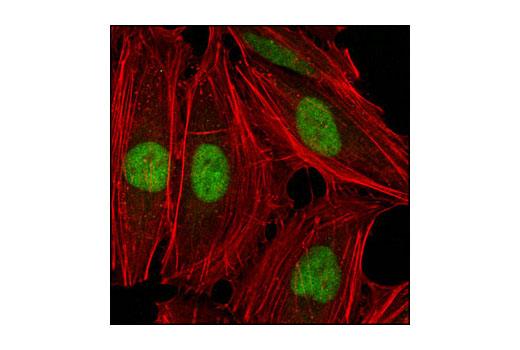 Confocal immunofluorescent analysis of HeLa cells using Ezh2 (AC22) Mouse mAb (green). Actin filaments have been labeled with Alexa Fluor® 555 phalloidin (red).