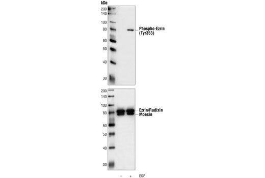 Western blot analysis of extracts from A431 cells, untreated or EGF-treated, using Phospho-Ezrin (Tyr353) Antibody (upper) or Ezrin/Radixin/Moesin Antibody #3142 (lower).