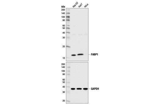Western blot analysis of extracts from Hep G2, Huh7, and HeLa cell lines using FABP1 (D2A3X) XP ® Rabbit mAb (upper) and GAPDH (D16H11) XP ® Rabbit mAb #5174 (lower).