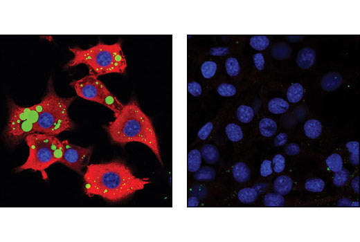 Confocal immunofluorescent analysis of differentiated 3T3-L1 cells (left) and undifferentiated 3T3-L1 cells (right), using FABP4 (D25B3) XP ® Rabbit mAb (red). Lipid droplets have been labeled with BODIPY 493/503 (green). Blue pseudocolor = DRAQ5 ® #4084 (fluorescent DNA dye).