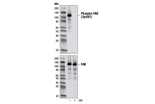 Western blot analysis of extracts from A549 cells, untreated or treated with calf intestinal phosphatase (CIP), using Phospho-FAK (Tyr397) (D20B1) Rabbit mAb (upper) and FAK Antibody #3285 (lower).