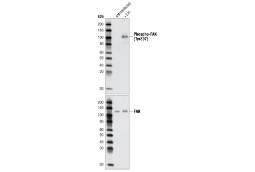 Western blot analysis of extracts from NIH/3T3 cells, untransfected or transfected with activated Src, using Phospho-FAK (Tyr397) Antibody (upper) or FAK Antibody #3285 (lower).