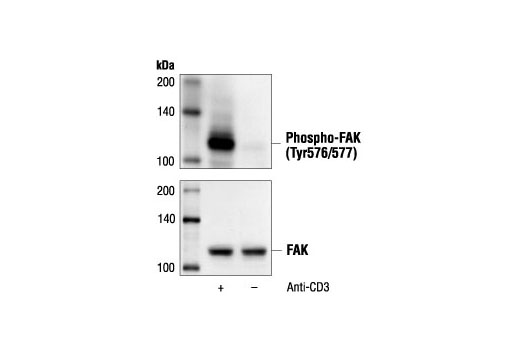 Western blot analysis of extracts from Jurkat cells, untreated or treated with anti-CD3 antibody (1 µg/ml for 10 minutes), using Phospho-FAK (Tyr576/577) Antibody (upper) or FAK antibody (lower).