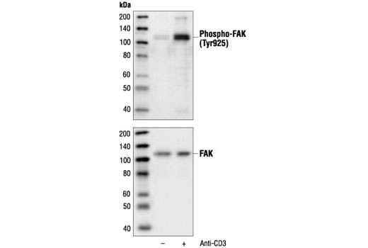 Western blot analysis of extracts from Jurkat cells, untreated or anti-CD3 antibody-treated (1 µg/ml for 10 minutes), using Phospho-FAK (Tyr925) Antibody (upper) or FAK antibody (lower).