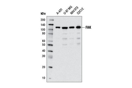 Western blot analysis of extracts from various cell lines using FAK (D2R2E) Rabbit mAb.