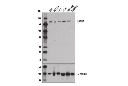 Western blot analysis of extracts from various cell lines using FANCA (D1L2Z) Rabbit mAb (upper) and α-Actinin (D6F6) XP ® Rabbit mAb #6487 (lower). As expected, GM06914 cells are negative for FANCA.