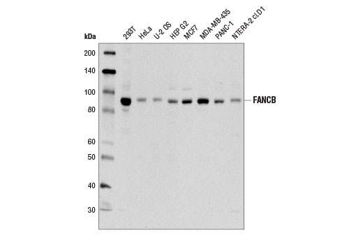 Western blot analysis of extracts from various cell types using FANCB (D9W6S) Rabbit mAb.