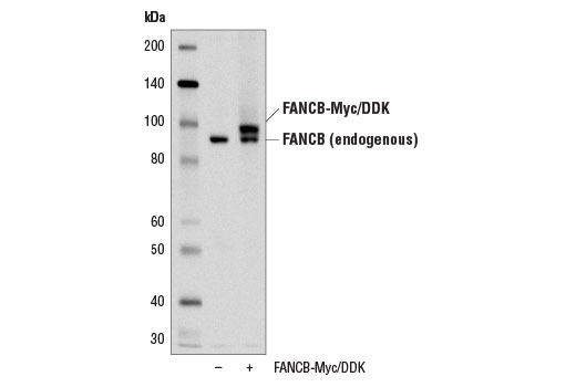 Western blot analysis of extracts from 293T cells, mock transfected (-) or transfected with a construct expressing Myc/DDK-tagged full-length human FANCB (FANCB-Myc/DDK; +) protein, using FANCB (D9W6S) Rabbit mAb.