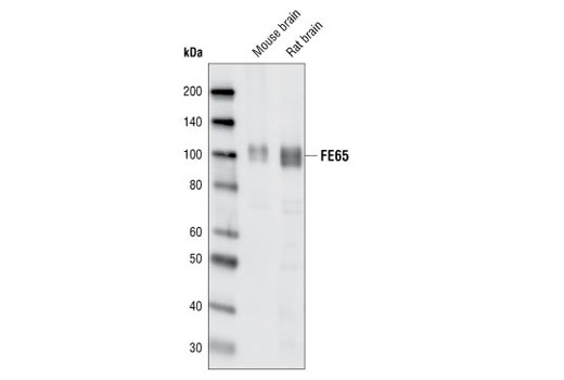 Western blot analysis of extracts from mouse and rat brain, using FE65 Antibody.