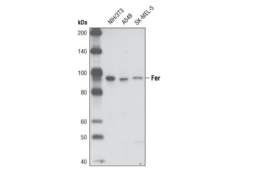 Western blot analysis of extracts from NIH/3T3, A549 and SK-MEL-5 cells using Fer (5D2) Mouse mAb.