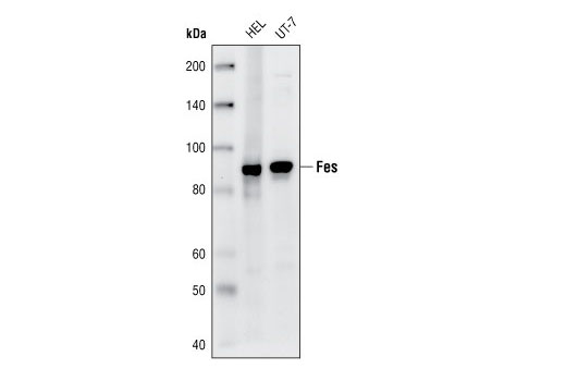 Western blot analysis of HEL and UT-7 cell lysates, using Fes Antibody.