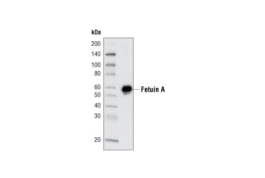 Western blot analysis of human serum using Fetuin A (F180) Antibody. Human serum (0.1 μl) was analyzed.