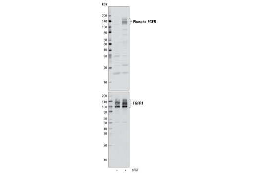 Western blot analysis of extracts from A-204 cells treated with or without bFGF, using Phospho-FGF Receptor (Tyr653/654) Antibody (upper) and FGF Receptor 1 (D8E4) XP® Rabbit mAb (lower).