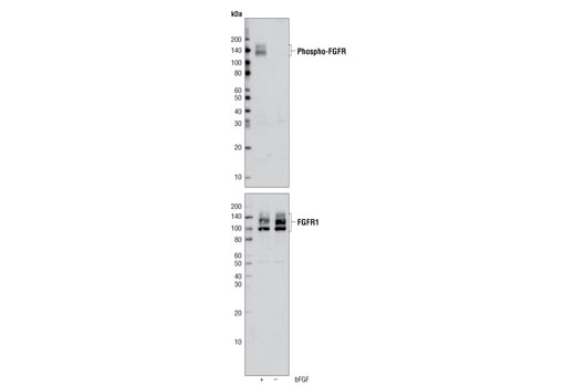 Western blot analysis of extracts from A-204 cells treated with or without bFGF, using Phospho-FGF Receptor (Tyr653/654) (55H2) Mouse mAb (upper) and FGF Receptor 1 (D8E4) XP® Rabbit mAb (lower).