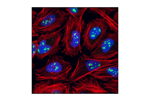 Confocal immunofluorescent analysis of HeLa cells using Fibrillarin (C13C3) Rabbit mAb (green). Actin filaments have been labeled with Alexa Fluor ® 555 phalloidin (red). Blue pseudocolor = DRAQ5® (fluorescent DNA dye).
