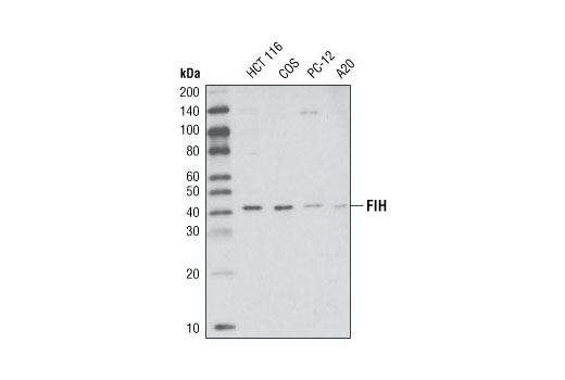 Western blot analysis of extracts from various cell types using FIH (D19B3) Rabbit mAb.