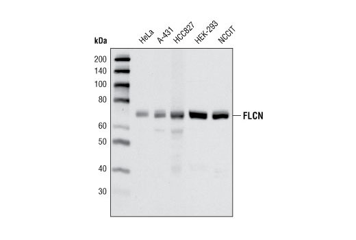 Western blot analysis of extracts from various cell lines using FLCN (D14G9) Rabbit mAb.